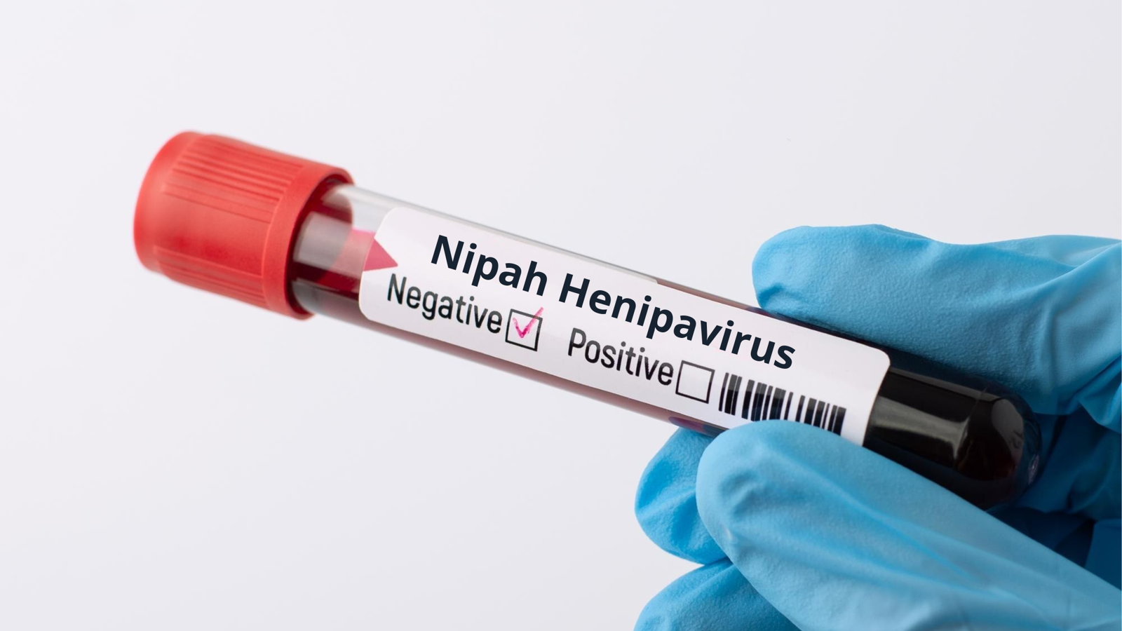 Virus Nipah: Apa Itu, Cara Penularan, Gejala, dan Upaya Pencegahan