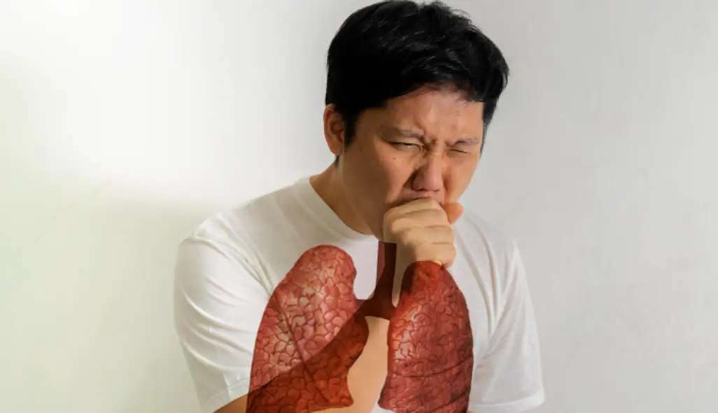 Bronkitis: Bedakan Antara Batuk Biasa dan Gangguan Paru yang Serius